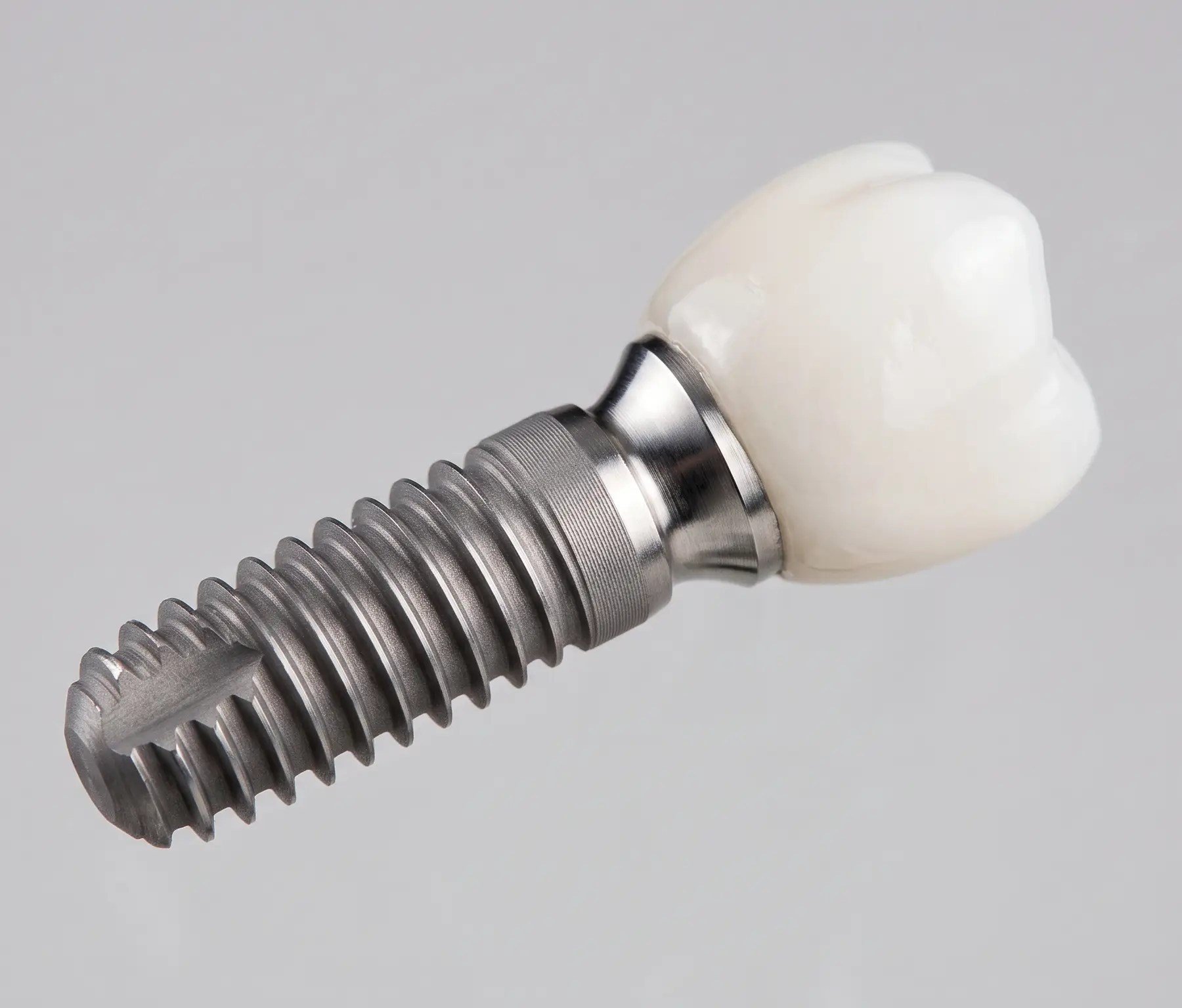 Implantologija - dentalni implantat